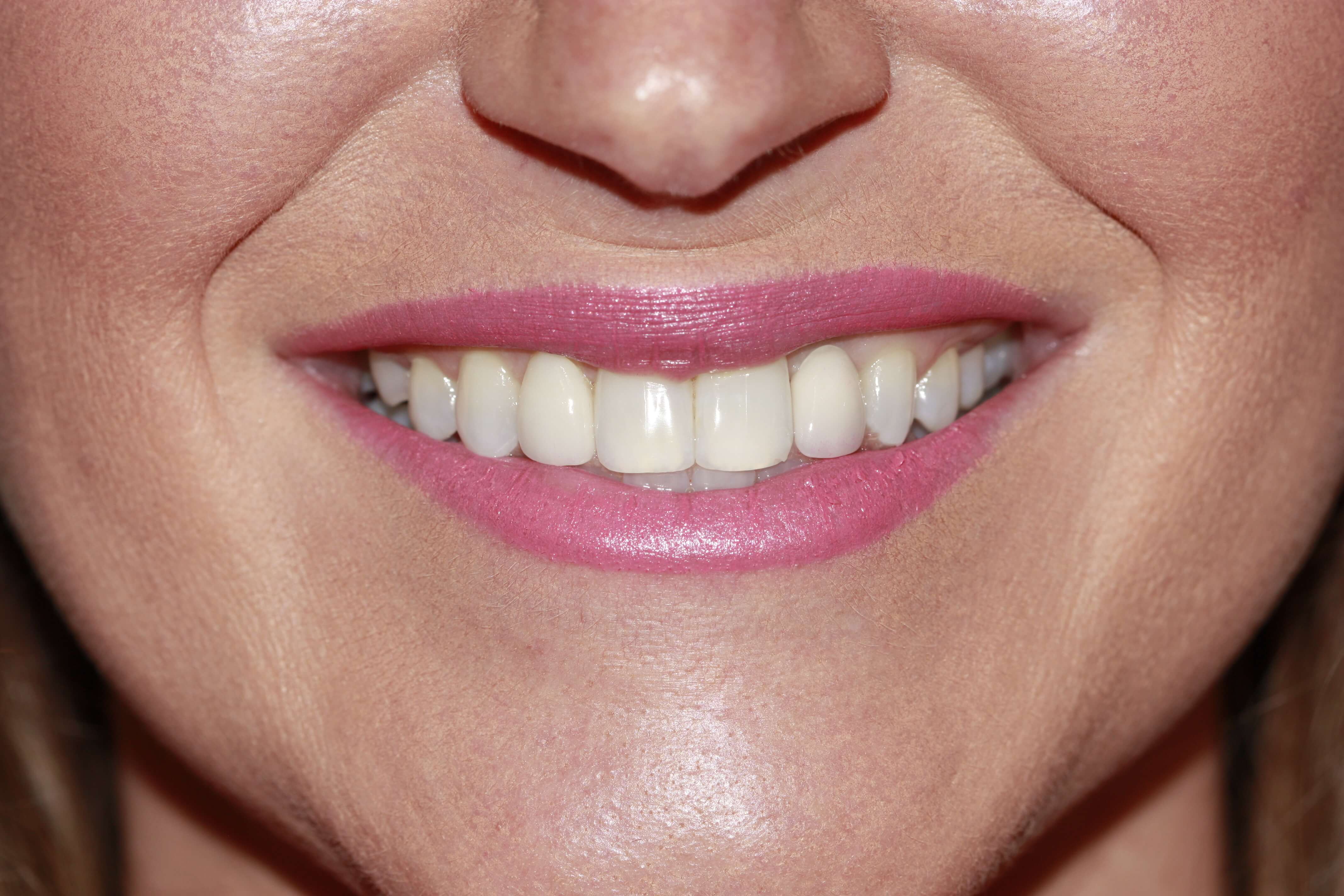 Close up of women's mouth