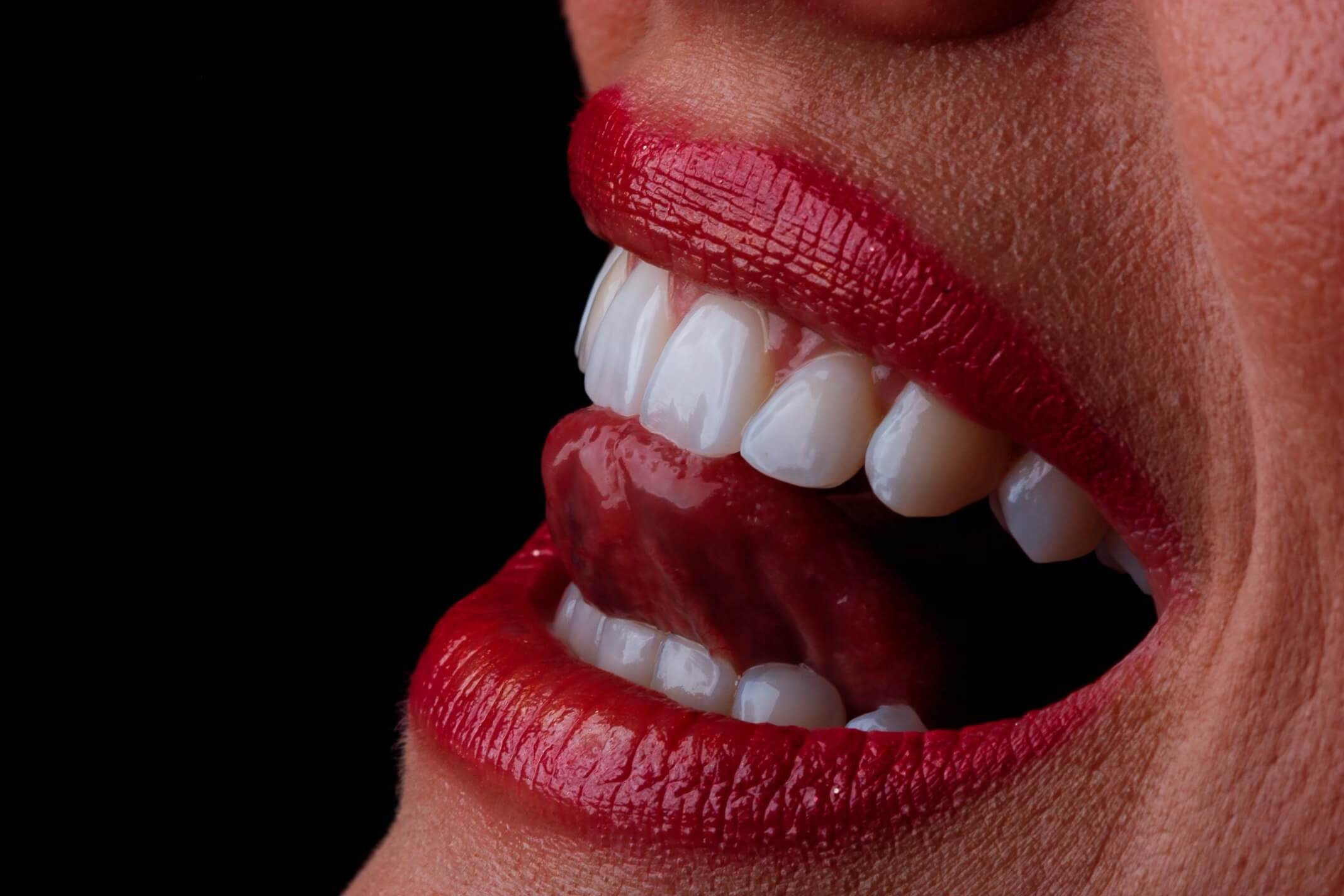 Women with Dental Crowns licking her lips