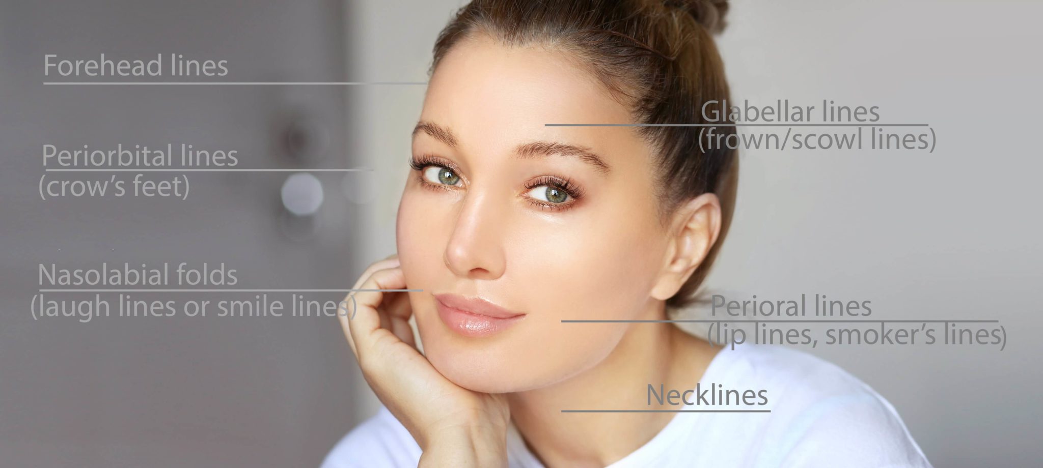 A women with Botox that discribes different